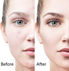 نظام ديرما رولر 6 في 1