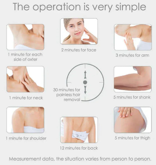 جهاز إزالة الشعر بالليزر بتقنية IPL